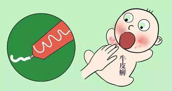 儿童得了牛皮癣家长父母应当注意什么事项呢?