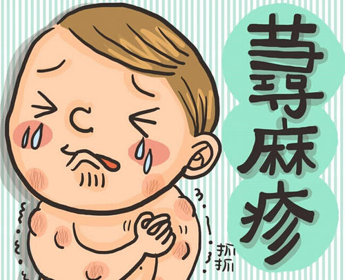 儿童得了荨麻疹都是什么样的症状及其损害呢?